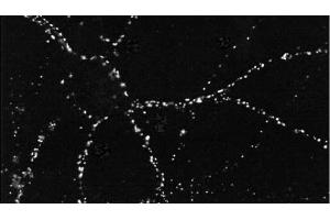 Immunocytochemistry/Immunofluorescence analysis using Mouse Anti-PSD95 Monoclonal Antibody, Clone 6G6 . (DLG4 Antikörper  (APC))