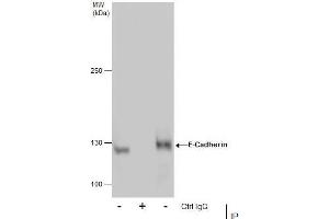 IP Image Immunoprecipitation of E-Cadherin protein from MCF-7 whole cell extracts using 5 μg of E-Cadherin antibody, Western blot analysis was performed using E-Cadherin antibody, EasyBlot anti-Rabbit IgG  was used as a secondary reagent. (E-cadherin Antikörper)