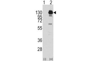 Western blot analysis of PDGFR alpha antibody and 293 cell lysate (2 ug/lane) either nontransfected (Lane 1) or transiently transfected with the human gene (2). (PDGFRA Antikörper  (AA 740-769))