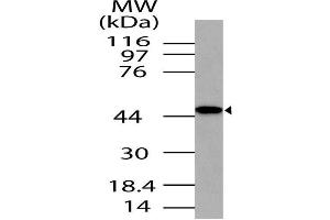 Image no. 1 for anti-TAR (HIV-1) RNA Binding Protein 2 Pseudogene (TARBP2P) (AA 150-366) antibody (ABIN5027591) (TRBP Antikörper  (AA 150-366))