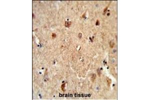 Formalin-fixed and paraffin-embedded human brain tissue reacted with CES7 Antibody (Center), which was peroxidase-conjugated to the secondary antibody, followed by DAB staining. (CES5A Antikörper  (AA 244-270))