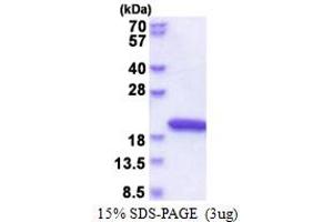 SDS-PAGE (SDS) image for NudC Domain Containing 2 (NUDCD2) (AA 1-157) protein (His tag) (ABIN5853569)