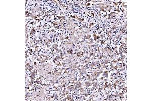 IHC analysis of RAB3GAP1 using anti-RAB3GAP1 antibody (ABIN7599702). (RAB3GAP1 Antikörper  (AA 109-810))