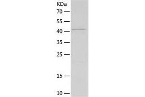 Western Blotting (WB) image for KIT Ligand (KITLG) (AA 26-189) protein (His-IF2DI Tag) (ABIN7123694) (KIT Ligand Protein (KITLG) (AA 26-189) (His-IF2DI Tag))