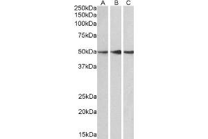 ABIN2564672 (0. (PPP2R5E Antikörper  (C-Term))