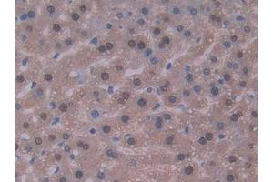 DAB staining on IHC-P; Samples: Mouse Liver Tissue (IL-22 Antikörper  (AA 34-179))