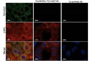 Immunohistochemistry of Rabbit anti-Sprouty2 antibody. (SPRY2 Antikörper  (Internal Region))