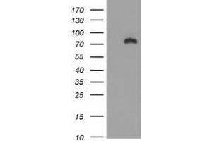 Image no. 2 for anti-Catenin (Cadherin-Associated Protein), beta 1, 88kDa (CTNNB1) antibody (ABIN1496891) (CTNNB1 Antikörper)