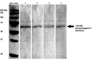 Western Blot analysis of Rat brain lysates showing detection of Synaptotagmin 7 protein using Mouse Anti-Synaptotagmin 7 Monoclonal Antibody, Clone S275-14 . (SYT7 Antikörper  (AA 150-239) (Atto 390))