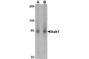 Western blot analysis of Aak1 in A-20 lysate with AP30003PU-N Aak1 antibody at (A) 1 and (B) 2 μg/ml.