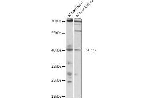Western blot analysis of extracts of various cell lines, using S1PR3 antibody (ABIN7270535) at 1:1000 dilution. (S1PR3 Antikörper  (AA 100-200))