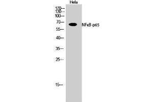 Western Blotting (WB) image for anti-Nuclear Factor-kB p65 (NFkBP65) (Thr72) antibody (ABIN3176327) (NF-kB p65 Antikörper  (Thr72))
