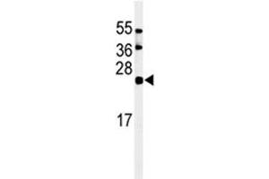 Western blot analysis of ISG15 antibody and HL-60 lysate (ISG15 Antikörper  (AA 136-165))