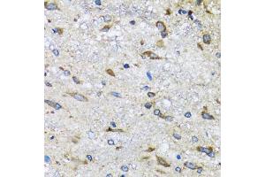 Immunohistochemistry of paraffin-embedded mouse spinal cord using BLZF1 antibody (ABIN2561429) at dilution of 1:100 (40x lens). (BLZF1 Antikörper)