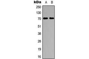 Western blot analysis of S6K1 expression in HeLa (A), HepG2 (B) whole cell lysates. (RPS6KB1 Antikörper  (Center))