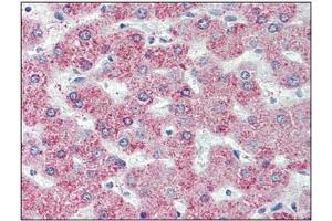 Immunohistochemistry: GPR146 antibody staining of Formalin-Fixed, Paraffin-Embedded Human Liver. (GPR146 Antikörper  (Internal Region))