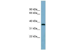 WB Suggested Anti-NEURL2 Antibody Titration: 0. (NEURL2 Antikörper  (Middle Region))