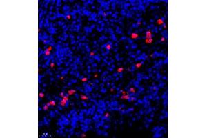 Immunofluorescence of paraffin embedded human lymph node using CSF1 (ABIN7073553) at dilution of 1:900 (400x lens) (M-CSF/CSF1 Antikörper)