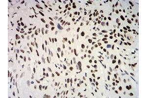 Immunohistochemistry (IHC) image for anti-Estrogen Receptor 1 (ESR1) (AA 2-185) antibody (ABIN5542593)