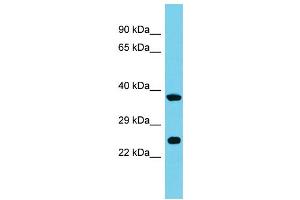 Host: Rabbit Target Name: MRPS26 Sample Type: 721_B Whole Cell lysates Antibody Dilution: 1.