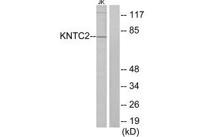 Western blot analysis of extracts from Jurkat cells, using KNTC2 antibody. (NDC80 Antikörper  (Internal Region))