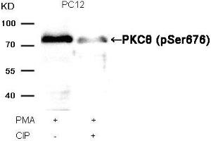 Western blot analysis of extracts from PC12 cells, treated with PMA or calf intestinal phosphatase (CIP), using PKCθ (Phospho-Ser676) Antibody. (PKC theta Antikörper  (pSer676))