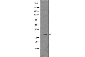 Western blot analysis of FGF3 using MCF7 whole  lysates. (FGF3 Antikörper)