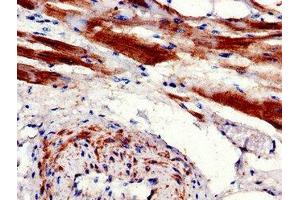 Immunohistochemistry of paraffin-embedded human heart tissue using ABIN7146837 at dilution of 1:100 (CPT1B Antikörper  (AA 165-318))