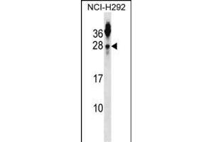 TSN2 Antibody (N-term) (ABIN1539218 and ABIN2848532) western blot analysis in NCI- cell line lysates (35 μg/lane). (Tetraspanin 2 Antikörper  (N-Term))