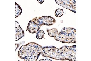 IHC analysis of TOP3B using anti-TOP3B antibody (ABIN7599907). (TOP3B Antikörper  (AA 128-824))