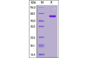 Human TNFSF11, Mouse IgG2a Fc Tag on  under reducing (R) condition. (RANKL Protein (AA 64-245) (Fc Tag))