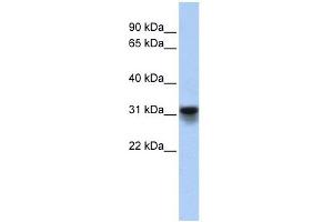 KDELR3 antibody used at 1 ug/ml to detect target protein.
