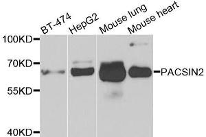 Western blot analysis of extracts of various cell lines, using PACSIN2 antibody. (PACSIN2 Antikörper  (AA 240-410))