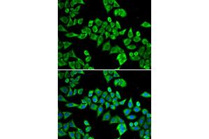 Immunofluorescence analysis of HeLa cells using DDX20 antibody. (DDX20 Antikörper)