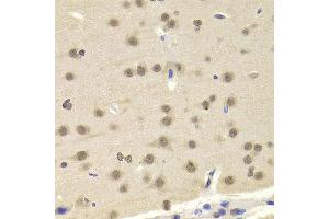 Immunohistochemistry of paraffin-embedded Mouse brain using ETV7 antibody at dilution of 1:100 (x400 lens). (ETV7 Antikörper)