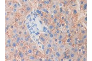 DAB staining on IHC-P; Samples: Human Liver Tissue (MYO1G Antikörper  (AA 769-1016))