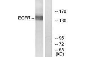 Western blot analysis of extracts from A431 cells, treated with EGF 40myM 10', using EGFR (Ab-869) Antibody. (EGFR Antikörper  (AA 836-885))