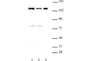 DHX9 antibody (mAb) (Clone 8E3) tested by Western blot. (DHX9 Antikörper  (N-Term))