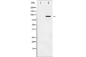 Western blot analysis of IKK- beta phosphorylation expression in TNF-a treated HeLa whole cell lysates,The lane on the left is treated with the antigen-specific peptide. (IKBKB Antikörper  (pTyr199))