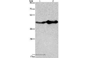 Western blot analysis of Mouse liver and brain tissue, using GLUL Polyclonal Antibody at dilution of 1:600 (GLUL Antikörper)