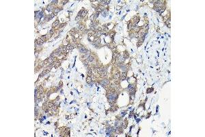 Immunohistochemistry of paraffin-embedded mouse testis using PIWIL4 Rabbit pAb (ABIN6132982, ABIN6145704, ABIN6145705 and ABIN6217111) at dilution of 1:100 (40x lens). (PIWIL4 Antikörper  (AA 260-460))