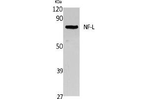 Western Blot analysis of extracts from Jurkat cells, using NF-L Polyclonal Antibody. (NEFL Antikörper  (C-Term))