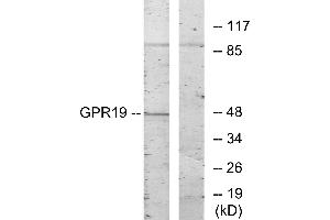 Western blot analysis of extracts from HeLa cells, using GPR19 antibody.