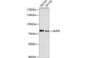 Western blot analysis of extracts of various cell lines, using AMFR antibody (ABIN1678650, ABIN3018012, ABIN3018013 and ABIN6220335) at 1:1000 dilution. (AMFR Antikörper  (AA 384-643))