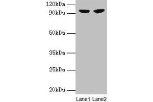 Western blot All lanes: PYGL antibody at 2 μg/mL Lane 1: 293T whole cell lysate Lane 2: HepG2 whole cell lysate Secondary Goat polyclonal to rabbit IgG at 1/10000 dilution Predicted band size: 98, 94 kDa Observed band size: 98 kDa (PYGL Antikörper  (AA 2-846))