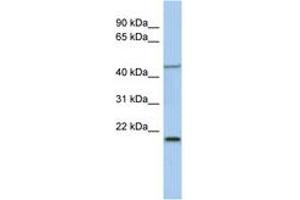 Image no. 1 for anti-Kruppel-Like Factor 15 (KLF15) (AA 215-264) antibody (ABIN6742232) (KLF15 Antikörper  (AA 215-264))