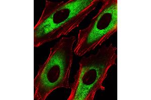 Fluorescent image of Hela cells stained with EEF1B2 Antibody . (EEF1B2 Antikörper  (AA 54-86))