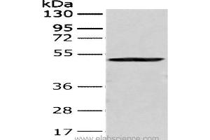 Western Blot analysis of 293T cell using CRTAM Polyclonal Antibody at dilution of 1:250 (CRTAM Antikörper)