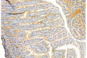 ABIN6262482 and ABIN6272876 at 1/100 staining Rat colon tissue by IHC-P. (IFT81 Antikörper  (Internal Region))