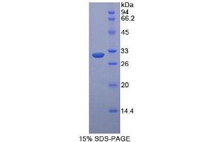 SDS-PAGE analysis of Mouse ASK1 Protein.